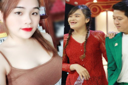 Đời sống Showbiz - "Thánh sún" Ngân Thảo tiếp tục thẩm mỹ, ngày càng "lột xác" sau khi nổi tiếng