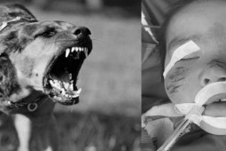 Sức khỏe đời sống - Tiêm phòng dại có bị suy giảm trí nhớ, giảm tuổi thọ?