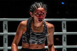 Thể thao - Đả nữ 17 tuổi đánh đàn chị bầm dập, trúng 2 đòn phải kêu bác sĩ