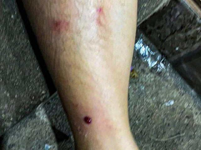 Đồng Nai: Điều tra vụ nổ súng làm 2 phụ nữ trọng thương