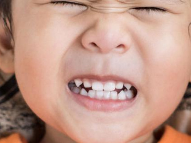 Sức khỏe đời sống - Tại sao trẻ lại nghiến răng?