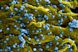 Sức khỏe đời sống - Bác sĩ BV Bạch Mai thông tin về loại virus khiến 9 người tử vong ở châu Phi