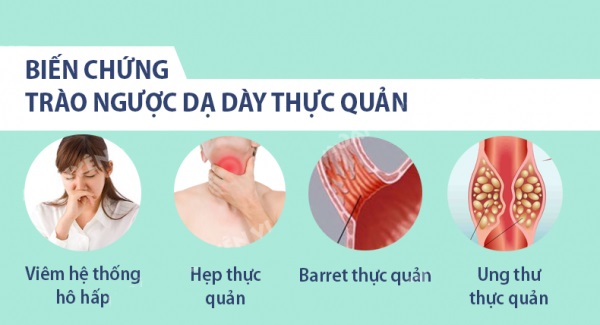 Đau tức ngực, khó thở, nuốt nghẹn – 3 dấu hiệu cảnh báo thực quản đang bị “bào mòn” mỗi ngày vì trào ngược dạ dày - 4