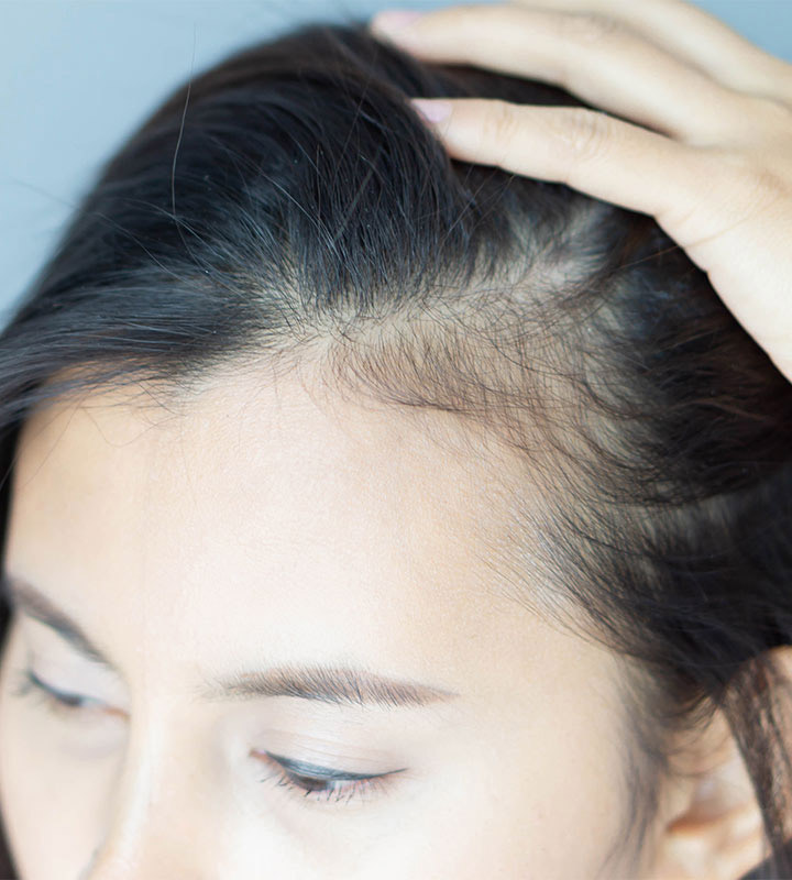 Các nhà tạo mẫu tóc cho biết 2 sai lầm khi gội đầu có thể làm tóc rụng - 1