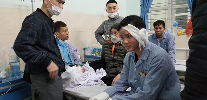 Các công nhân bị bỏng ở vùng mặt, tay đang điều trị tại bệnh viện.