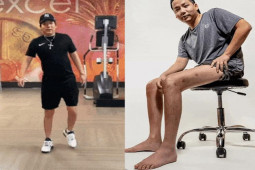 Giải trí - Khoa Pug chi 5 tỷ để có "đôi chân đầy sẹo", bà Tân Vlog và các hiện tượng mạng khác thì sao?