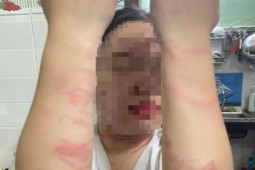 Pháp luật - Điều tra vụ việc thiếu nữ 17 tuổi bị mẹ ruột đánh gây thương tích ở TP Thủ Đức