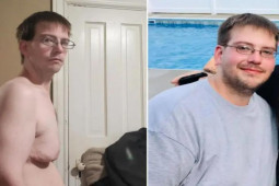 Bạn trẻ - Cuộc sống - Chàng trai “khốn khổ” vì sở hữu vòng 1 lớn bất thường