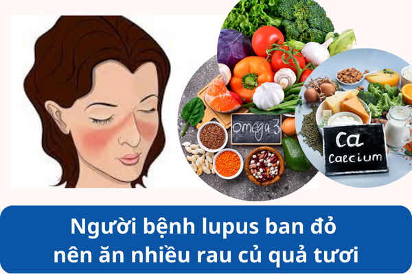 Người bệnh lupus ban đỏ nên ăn nhiều rau củ quả tươi, thực phẩm giàu omega 3 và canxi