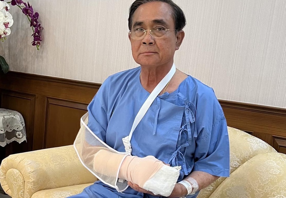 Ông Prayut Chan-o-cha&nbsp;được băng bó tay, ảnh chụp tại bệnh viện Phramongkutklao vào chiều ngày 4/3 (ảnh: Bangkok Post)