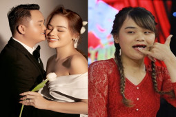 Đời sống Showbiz - "Thánh sún" Ngân Thảo tung ảnh cưới, nhan sắc sau phẫu thuật thẩm mỹ gây chú ý