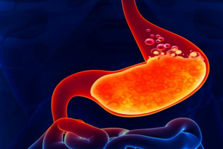 10 hành vi tồi tệ nhất khiến dạ dày bị tổn thương nhưng nhiều người...