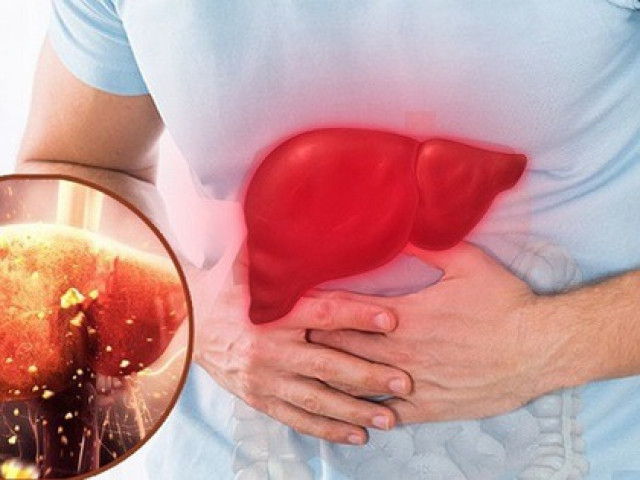 Sức khỏe đời sống - Điểm mặt những thực phẩm tồi tệ nhất cho sức khỏe lá gan