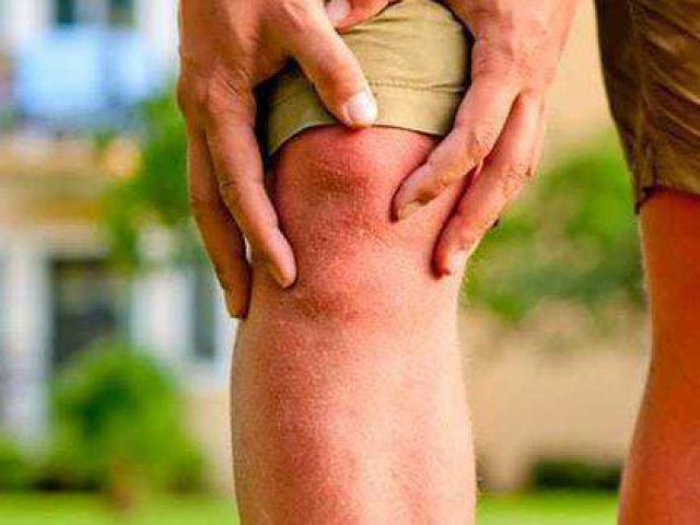 Sức khỏe đời sống - Đầu gối có biểu hiện này khi đi bộ, có 4 bệnh cần khám ngay