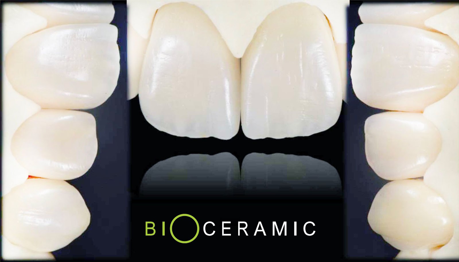 Công nghệ răng sứ sinh học Bio Ceramic – Đột phá cho thị trường răng sứ truyền thống - 1