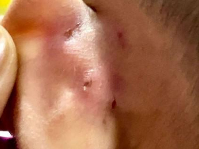 Bạo hành bé trai 4 tuổi thương tích, cô giáo mầm non bị khởi tố