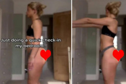 Bạn trẻ - Cuộc sống - Mặc hớ hênh tập thể dục, cô gái gặp tình huống xấu hổ