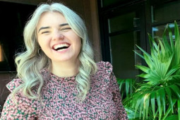 Bạn trẻ - Cuộc sống - Cô gái có mái tóc bạc trắng khi mới 25 tuổi