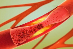 Sức khỏe đời sống - Người đàn ông 56 tuổi uống giấm mỗi ngày để làm mềm mạch máu, 6 tháng sau kết quả ra sao?