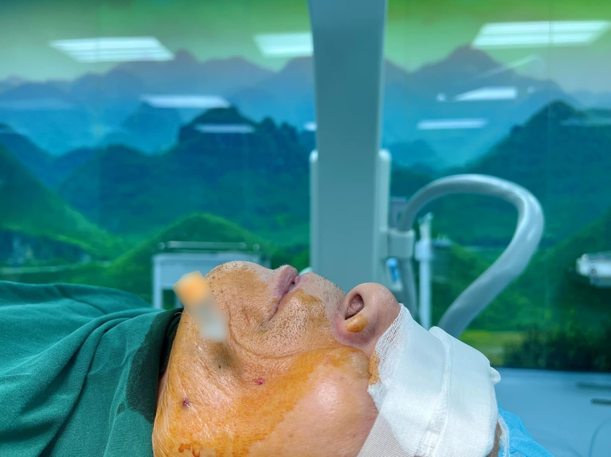 Hình ảnh bệnh nhân đang được thực hiện tiêm cồn diệt hạch Gasser