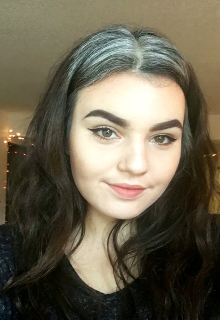 Zoë Miolla thích vẻ ngoài "độc nhất vô nhị" của mình