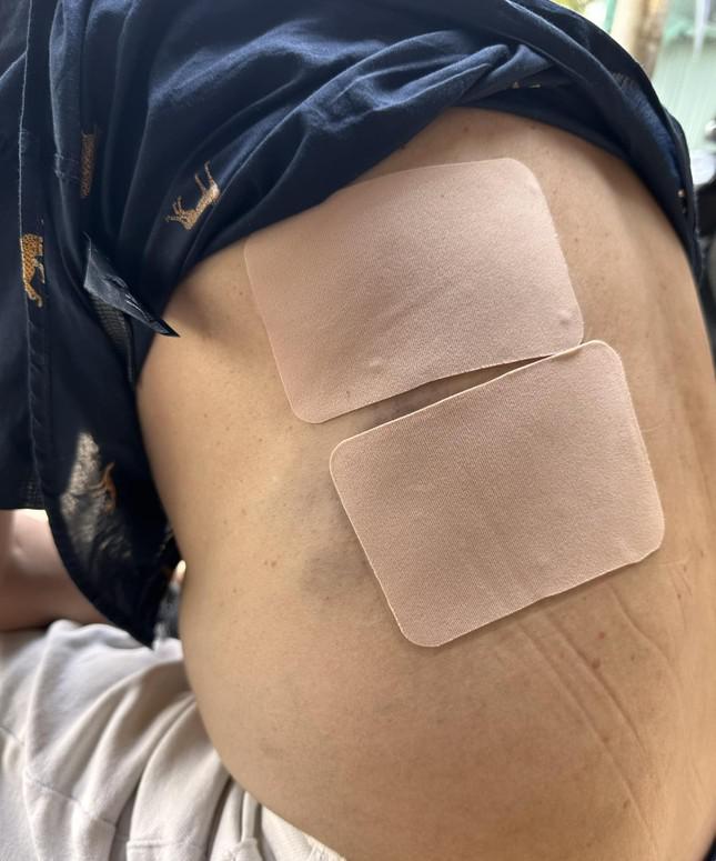 Nghệ sĩ Tấn Beo bất tỉnh sau khi rơi tự do xuống cầu thang - 1