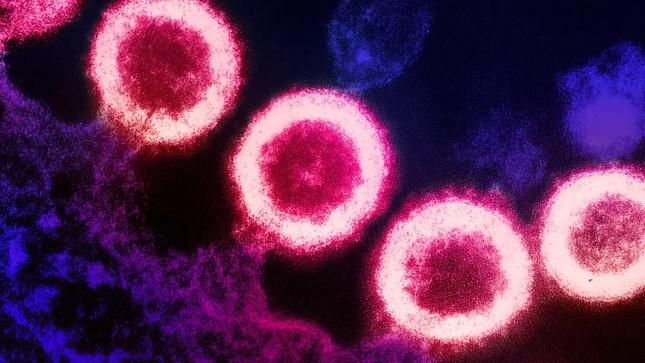 Thông tin thêm về người phụ nữ đầu tiên được ghép tế bào gốc chữa khỏi HIV - 1