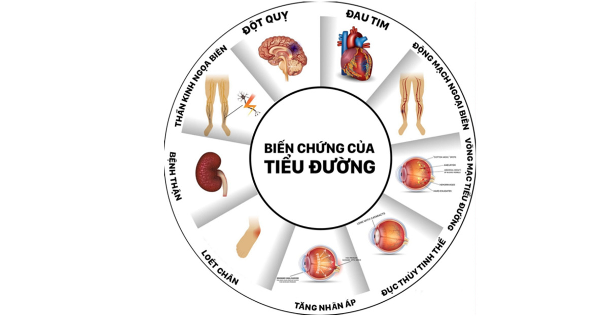 Biến chứng nguy hiểm thường gặp của đái tháo đường