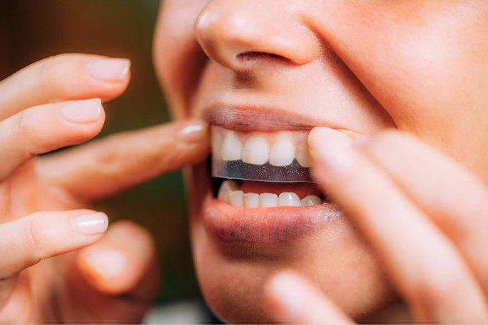 5 kiểu làm trắng răng tại nhà phổ biến: Chuyên gia tiết lộ sự thật - 2