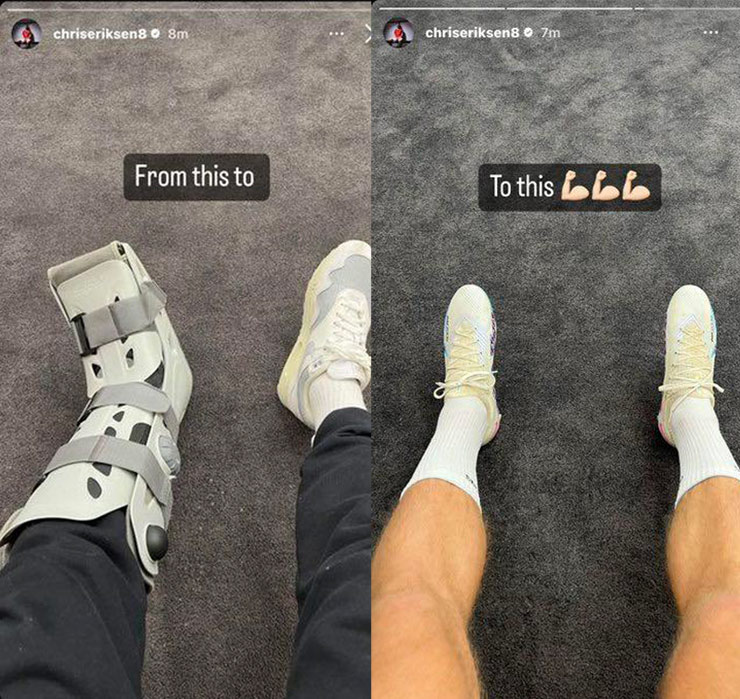 Christian Eriksen khoe ảnh vừa tháo ủng bảo vệ chân trái dính chấn thương cho thấy dấu hiệu anh sắp trở lại tập luyện
