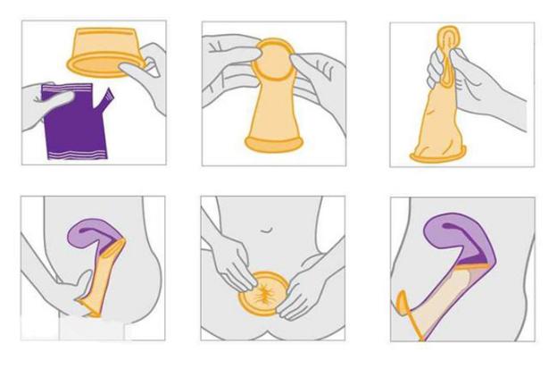 6 bước sử dụng bao cao su nữ dễ dàng và đạt khoái cảm tối đa - 3