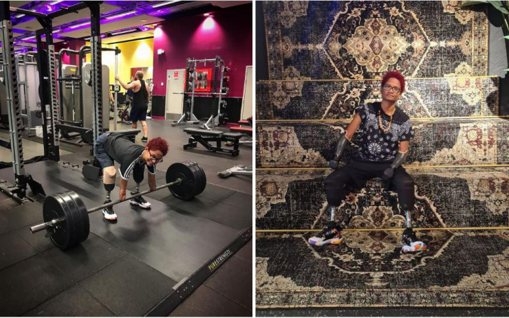 Người phụ nữ cố gắng sống một cuộc sống mới với chiếc chân giả và cánh tay giả.