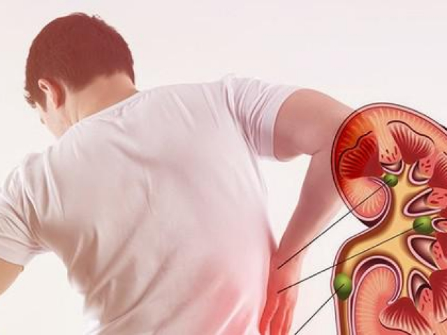 Sức khỏe đời sống - Những sai lầm khi ăn uống khiến thận phải "kêu cứu", ai cũng ít nhất một lần mắc phải