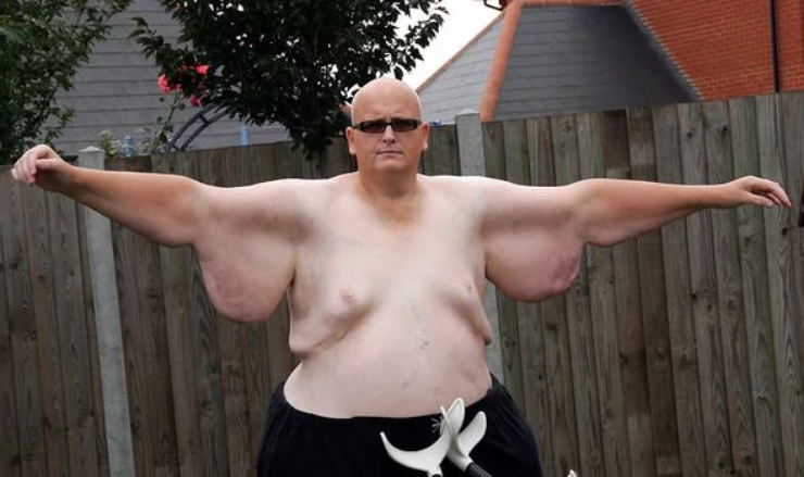 Sốc trước lượng thực phẩm của người đàn ông béo nhất thế giới ăn mỗi ngày - 4