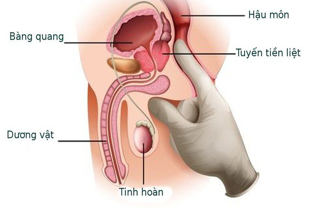 Bệnh ở tuyến tiền liệt có ảnh hưởng đến khả năng tình dục?- Ảnh 1.