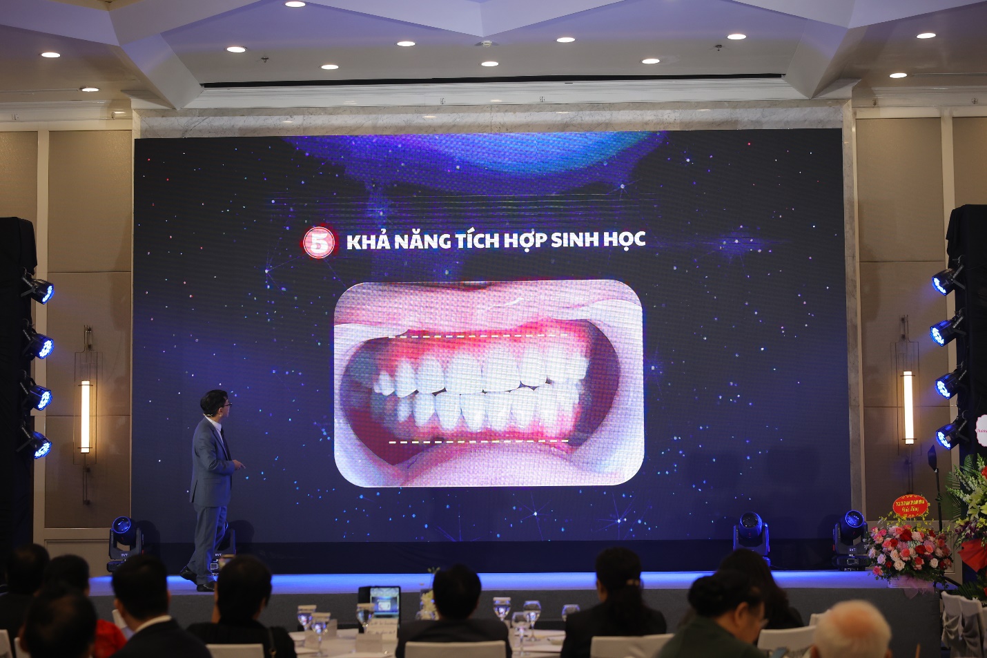 Mặt dán sứ SmartVeneer - bước đột phá cho sức khỏe răng miệng toàn diện - 2