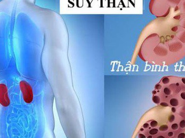 Sức khỏe đời sống - Tiết lộ 3 thói quen xấu khiến nữ Tiktoker xinh đẹp mắc suy thận độ 3, chuyên gia khuyến cáo giới trẻ nên duy trì thói quen này để phòng bệnh!