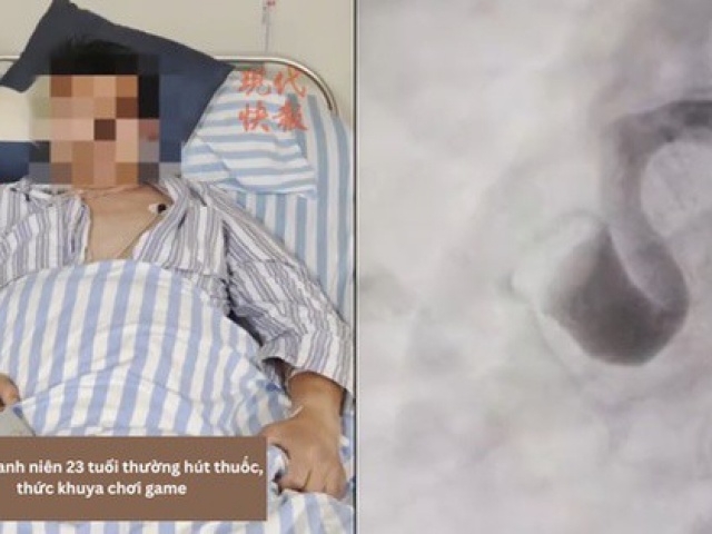 Sức khỏe đời sống - Thanh niên 23 tuổi bị nhồi máu cơ tim nguy kịch vì thường xuyên làm việc này