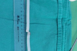 Sức khỏe đời sống - Người đàn ông tự nhét cây keo nến dài 40 cm vào “vùng kín” để tăng khoái cảm