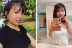 Bạn trẻ - Cuộc sống - Cô gái Đắk Nông sau 7 năm phẫu thuật thẩm mỹ HOT nhất tuần qua