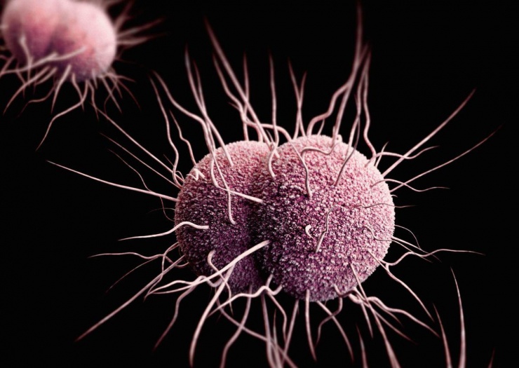Hình minh họa này hiển thị hình ảnh do máy tính tạo ra về Neisseria gonorrhoeae kháng thuốc, loại vi khuẩn gây bệnh lậu. (Nguồn hình ảnh: CDC/James Archer).