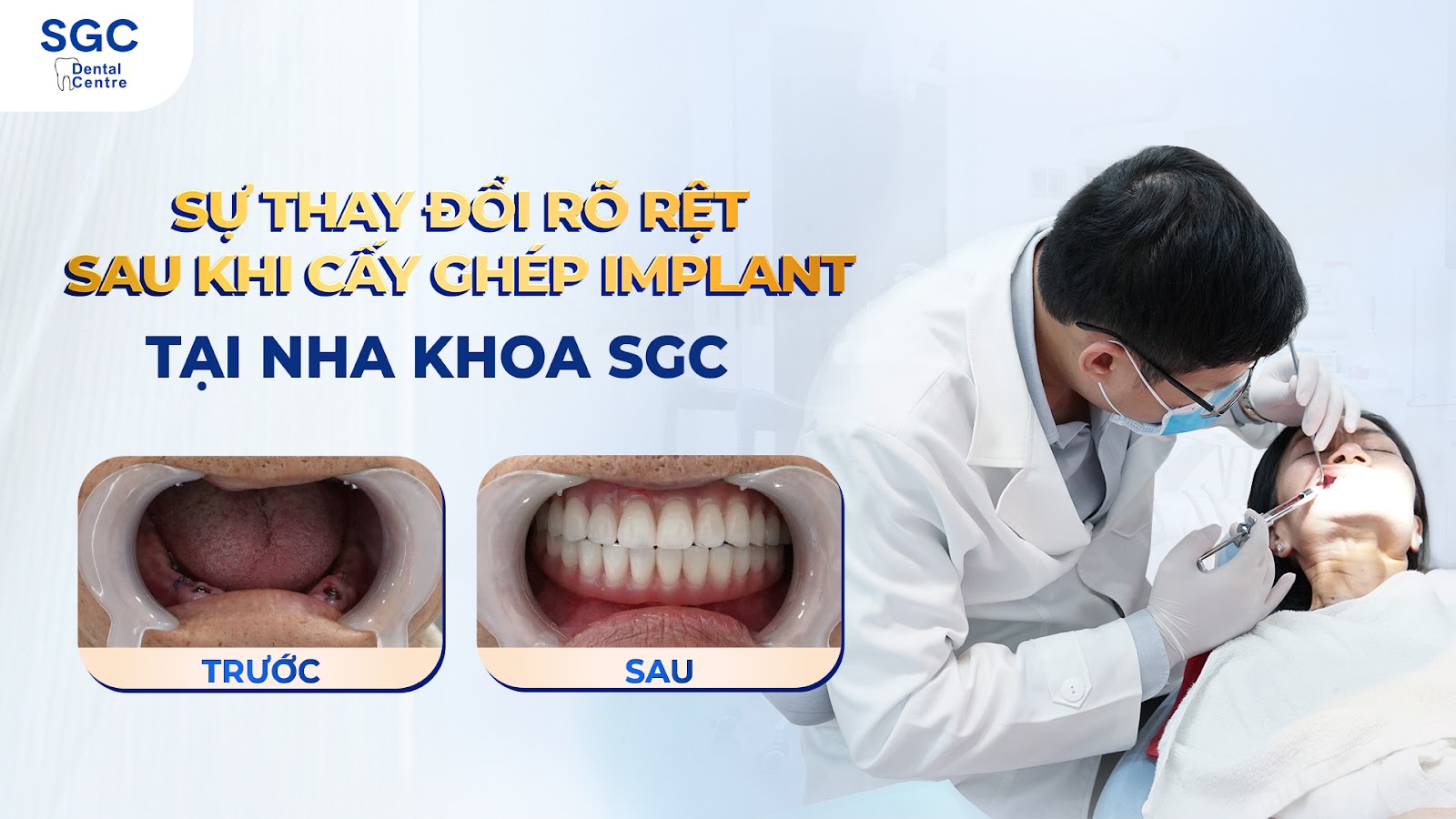 Dịch vụ trồng răng Implant uy tín TPHCM tại Nha Khoa SGC - 5