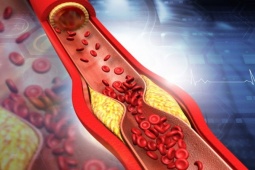 Sức khỏe đời sống - Vì sao nhiều người gầy vẫn bị mỡ máu?