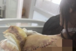 Tin tức trong ngày - Tin tức 24h qua: Người phụ nữ 2 lần bị truy sát, công an tăng cường bảo vệ