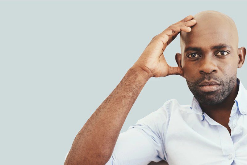 Những kiểu râu ngắn đẹp nhất dành cho nam giới: Tìm kiếm vẻ ngoài hoàn hảo - 3