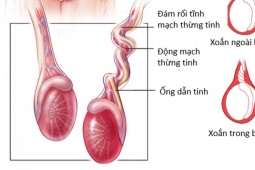 Sức khỏe đời sống - Nam thanh niên 16 tuổi bị xoắn tinh hoàn sau cơn đau đột ngột vùng bìu