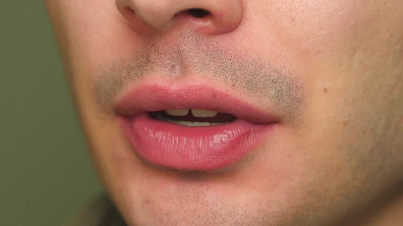 6 cách giúp chàng trị thâm môi cực hiệu quả - 1