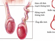 Sức khỏe đời sống - Nam thanh niên 16 tuổi bị xoắn tinh hoàn sau cơn đau đột ngột vùng bìu