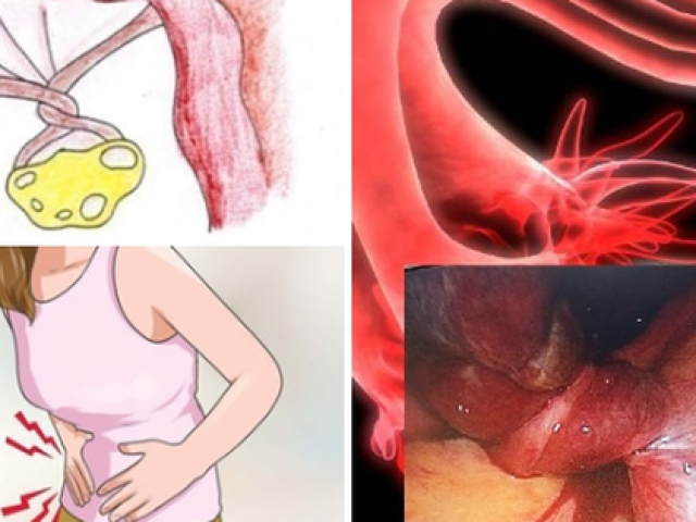 Sức khỏe đời sống - Bé gái 9 tuổi đau bụng rồi nôn ói, đi khám mới biết mắc bệnh hiểm, bác sĩ chỉ rõ chị em có dấu hiệu này cần khám ngay!