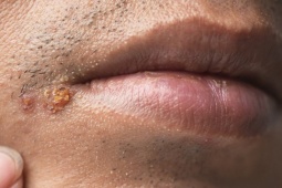 Sức khỏe đời sống - "Yêu" bằng miệng rất dễ khiến bạn mắc 3 loại bệnh nguy hiểm